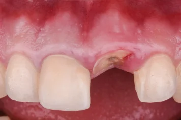 Before treatment — clinical photo