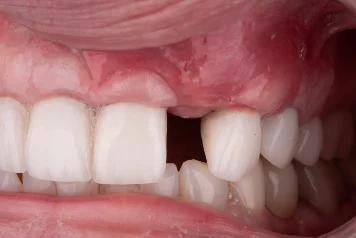 After treatment — clinical photo