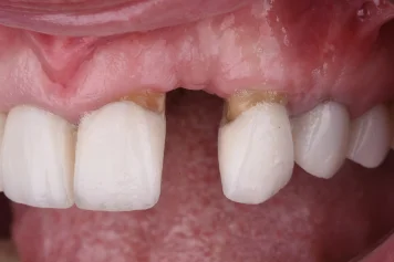 Before treatment — clinical photo
