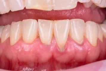 Before treatment — clinical photo